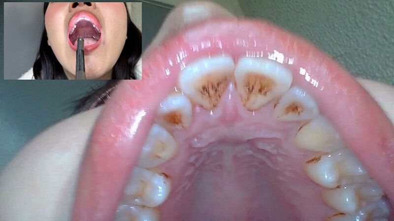 街角で声をかけて口内観察させてもらう コールセンターアルバイト あむちゃん ギャラリー 13