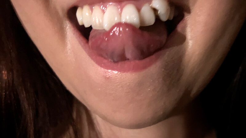 街角で声をかけて口内観察させてもらう 時計屋店員 みらいちゃん ギャラリー 7