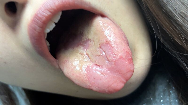 街角で声をかけて口内観察させてもらう 大学生 ゆゆちゃん ギャラリー 20