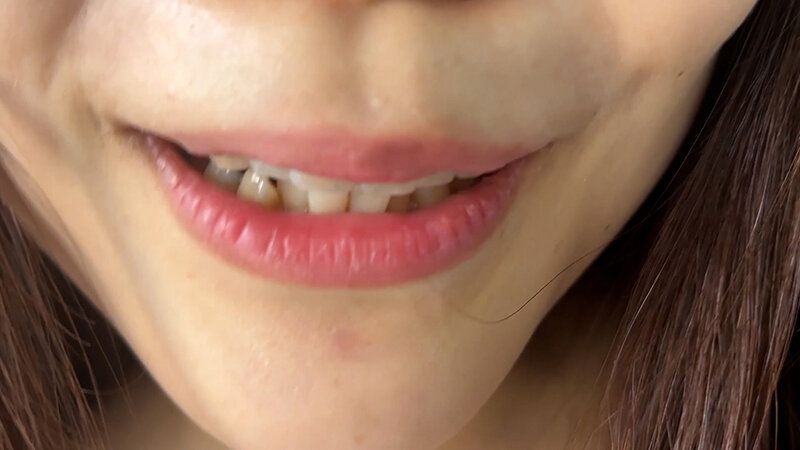 街角で声をかけて口内観察させてもらう アパレル店員 さゆりちゃん ギャラリー 7