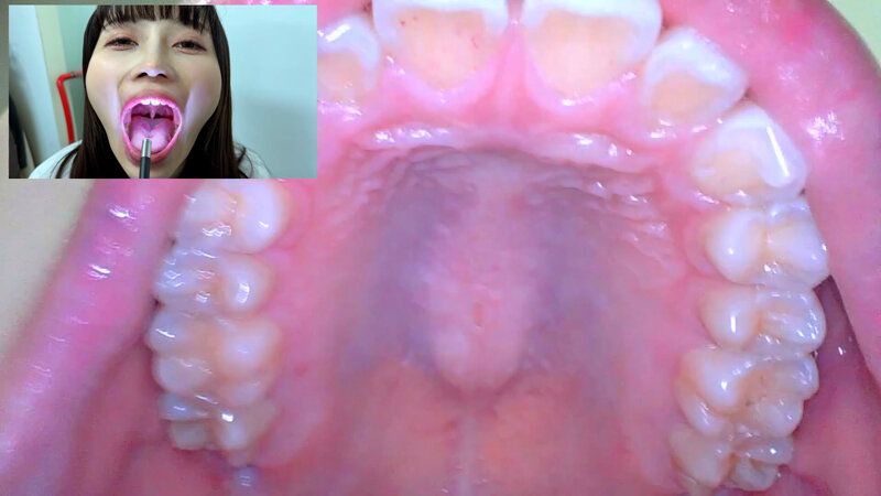 街角で声をかけて口内観察させてもらう アパレル関係 ひなみちゃん ギャラリー 10