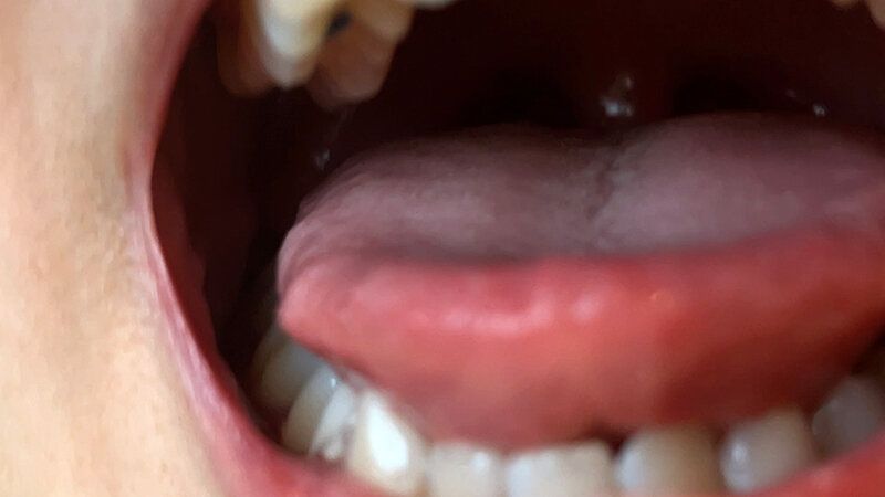 街角で声をかけて口内観察させてもらう カフェ店員 ひなちゃん ギャラリー 5