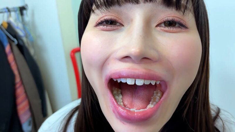 街角で声をかけて口内観察させてもらう アパレル関係 ひなみちゃん ギャラリー 13