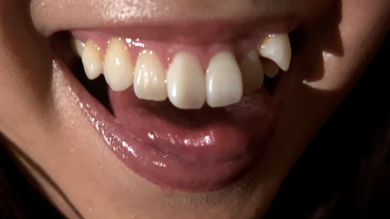 街角で声をかけて口内観察させてもらう 時計屋店員 みらいちゃん ギャラリー 13