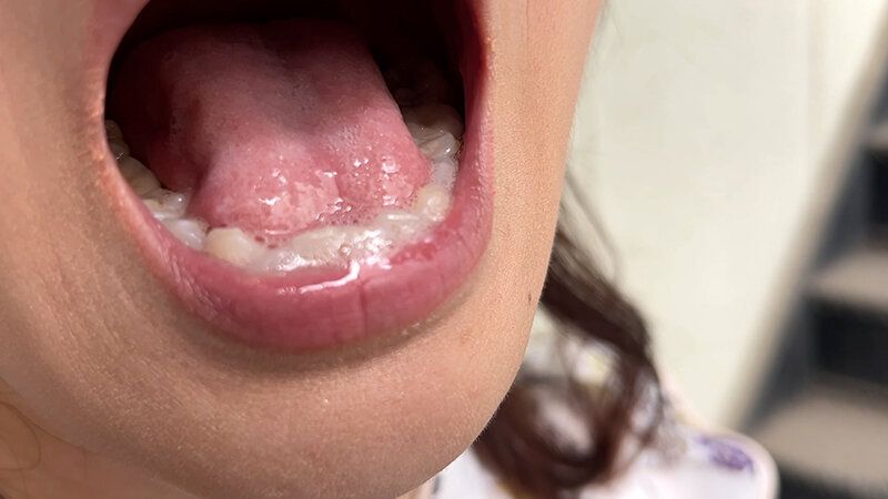 街角で声をかけて口内観察させてもらう スーパーのパート店員 まきさん ギャラリー 13