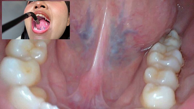 街角で声をかけて口内観察させてもらう コールセンターアルバイト あむちゃん ギャラリー 15