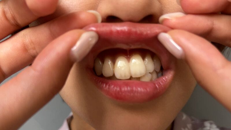 街角で声をかけて口内観察させてもらう パティシエ さらちゃん ギャラリー 11