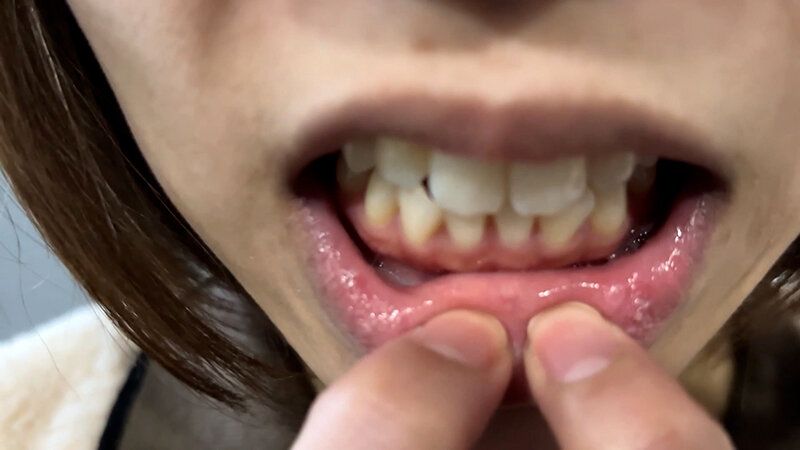 街角で声をかけて口内観察させてもらう オーガニックスーパー勤務 はつみちゃん ギャラリー 12