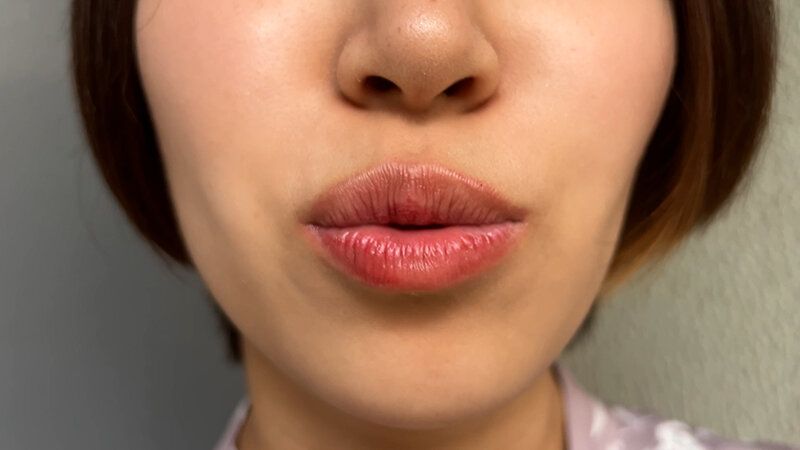 街角で声をかけて口内観察させてもらう パティシエ さらちゃん ギャラリー 6