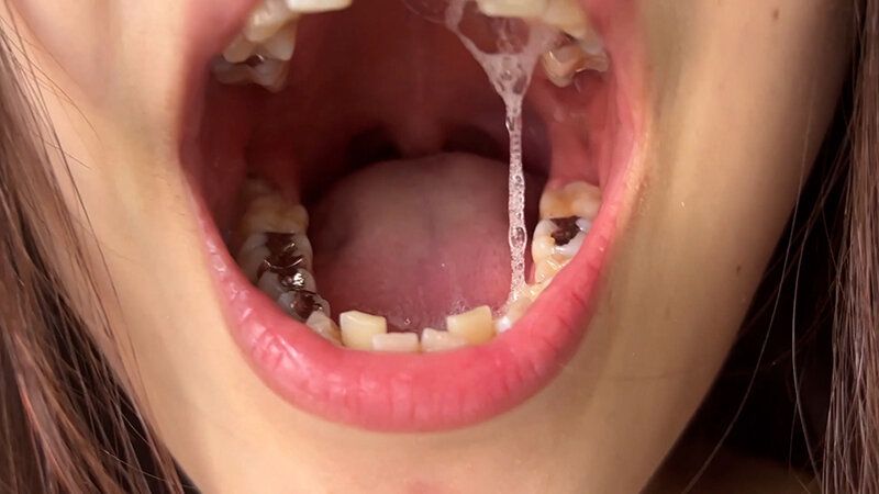 街角で声をかけて口内観察させてもらう アパレル店員 さゆりちゃん ギャラリー 20