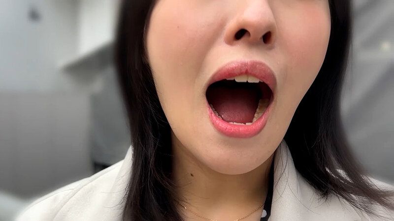 街角で声をかけて口内観察させてもらう スレンダーOL あいちゃん ギャラリー 3