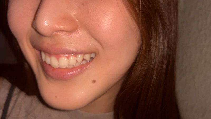 街角で声をかけて口内観察させてもらう 福祉系の専門学生 なぎさちゃん ギャラリー 9