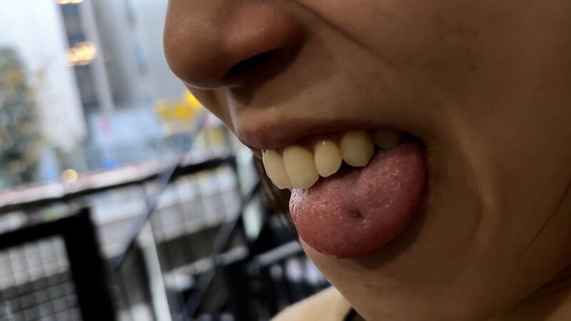 街角で声をかけて口内観察させてもらう オーガニックスーパー勤務 はつみちゃん ギャラリー 17