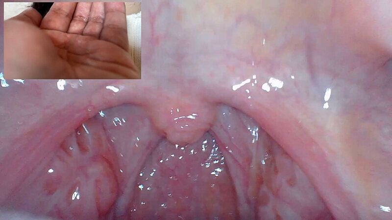 街角で声をかけて口内観察させてもらう コールセンターアルバイト あむちゃん ギャラリー 19