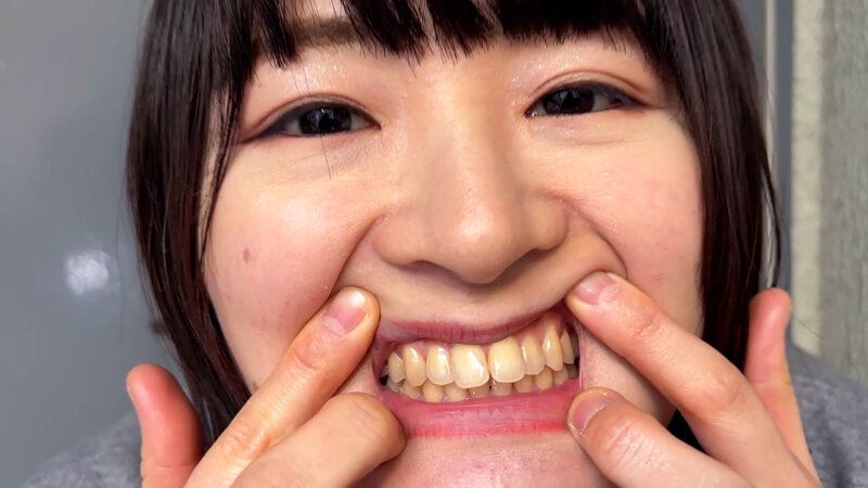 街角で声をかけて口内観察させてもらう 飲食店アルバイト みこちゃん ギャラリー 11