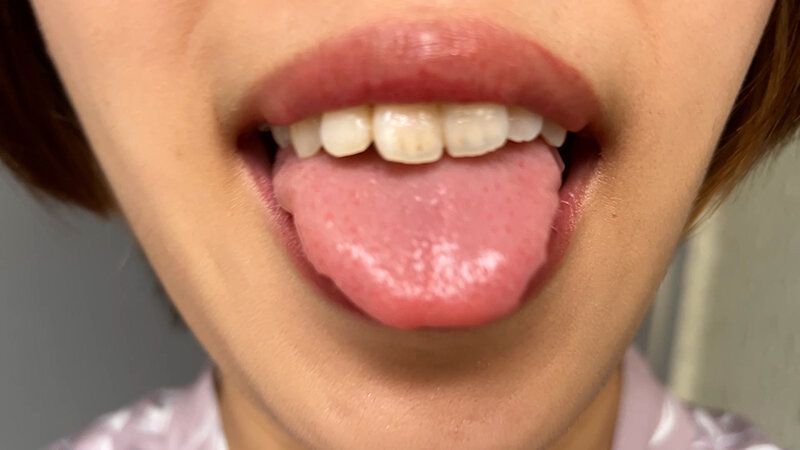 街角で声をかけて口内観察させてもらう パティシエ さらちゃん ギャラリー 5