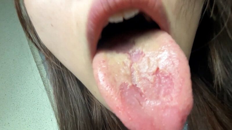 街角で声をかけて口内観察させてもらう 大学生 ゆゆちゃん ギャラリー 15