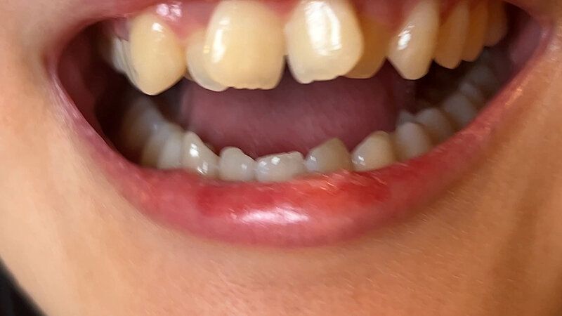 街角で声をかけて口内観察させてもらう カフェ店員 ひなちゃん ギャラリー 10