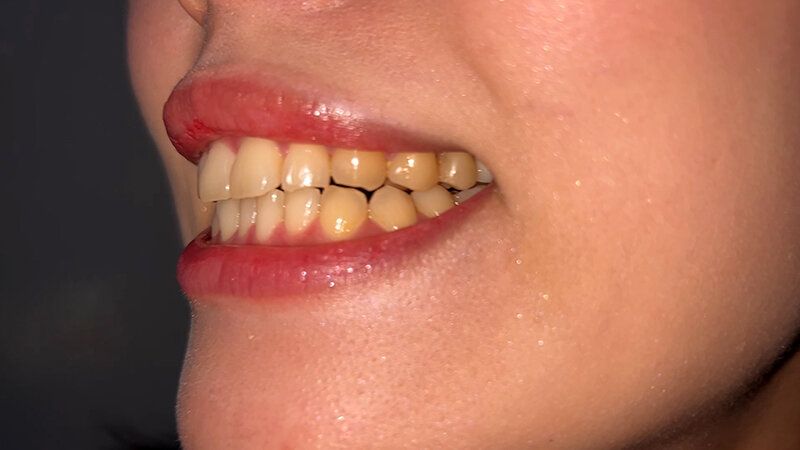 街角で声をかけて口内観察させてもらう スレンダーOL あいちゃん ギャラリー 7