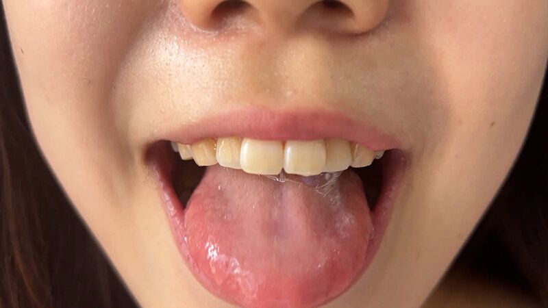 街角で声をかけて口内観察させてもらう アパレル店員 さゆりちゃん ギャラリー 9