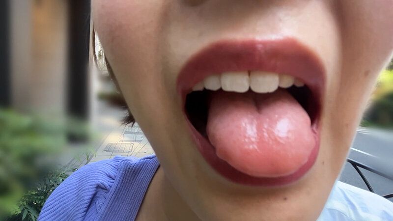 街角で声をかけて口内観察させてもらう アパレル店員 さつきちゃん ギャラリー 6