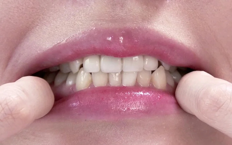 歯フェチ ～じっくり歯観察～ 朝日しずく