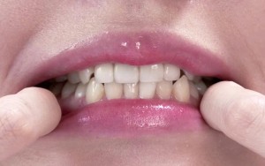 歯フェチ ～じっくり歯観察～ 朝日しずく ギャラリー 5