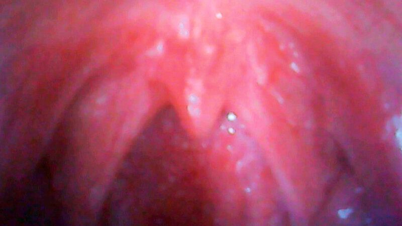 ベロキスフェラ舐め唾ダラ舌交ちゅうちゅう口戯 篠咲らら ギャラリー 3