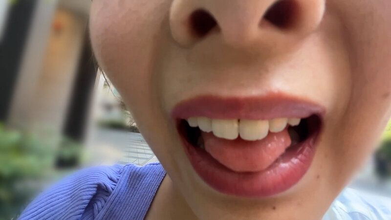 街角で声をかけて口内観察させてもらう アパレル店員 さつきちゃん ギャラリー 5