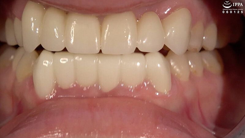 【歯・口腔フェチ】「超敏感女優 琥珀ややちゃんの口内観察＆巨大女フェチ」WAKA-077琥珀やや ギャラリー 3