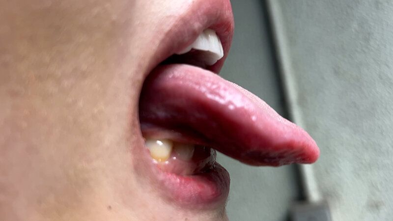 街角で声をかけて口内観察させてもらう エッチで金欠な女の子 ゆりなちゃん ギャラリー 8