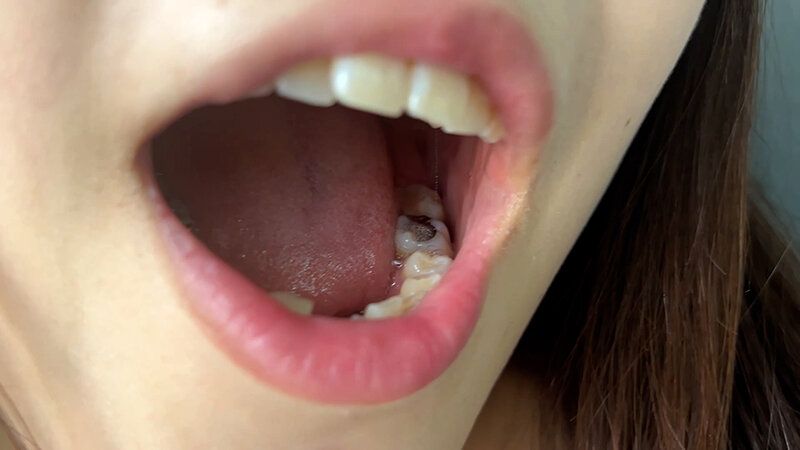 街角で声をかけて口内観察させてもらう アパレル店員 さゆりちゃん ギャラリー 14