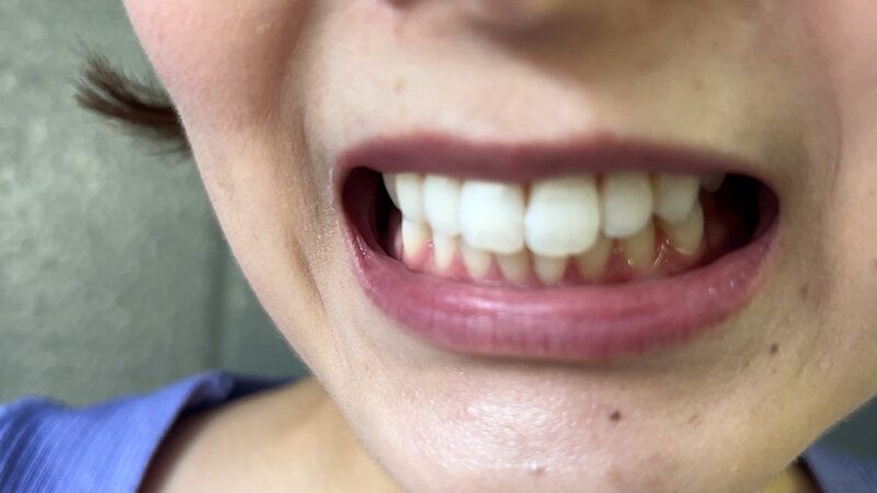 街角で声をかけて口内観察させてもらう アパレル店員 さつきちゃん ギャラリー 8