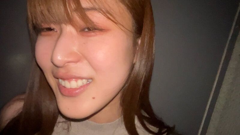 街角で声をかけて口内観察させてもらう 福祉系の専門学生 なぎさちゃん ギャラリー 19