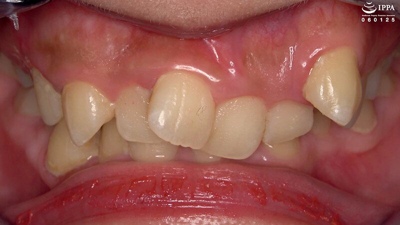 「【歯・口腔フェチ】新人女優相楽さゆなちゃんの口内観察＆巨大女フェチ」わかしラボWAKA-078 相楽さゆな 9 ギャラリー 3