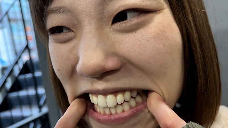 街角で声をかけて口内観察させてもらう オーガニックスーパー勤務 はつみちゃん ギャラリー 13