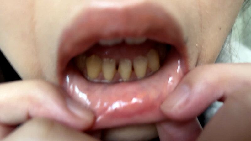 街角で声をかけて口内観察させてもらう コールセンターアルバイト あむちゃん ギャラリー 5