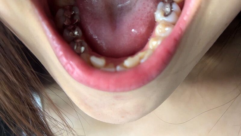 街角で声をかけて口内観察させてもらう アパレル店員 さゆりちゃん ギャラリー 6