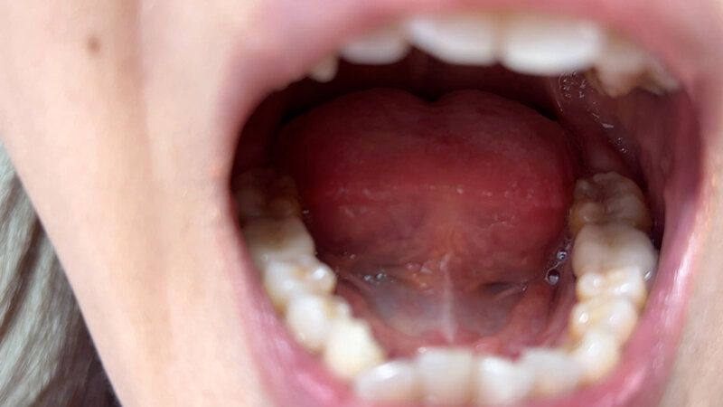 街角で声をかけて口内観察させてもらう スーパーのパート店員 まきさん ギャラリー 5