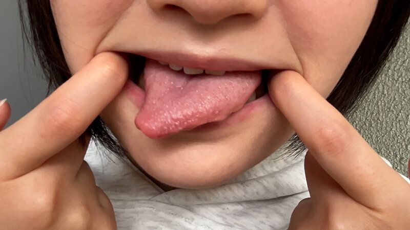 街角で声をかけて口内観察させてもらう 子供英語塾アルバイト のあちゃん ギャラリー 14