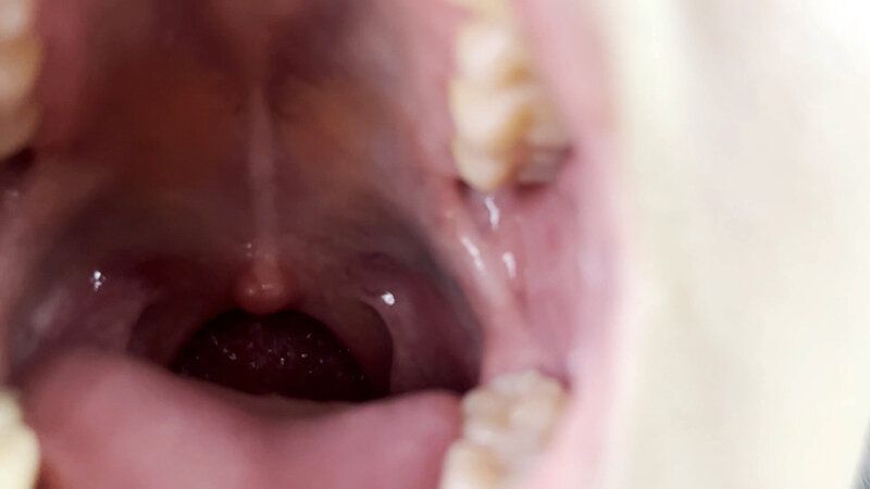 街角で声をかけて口内観察させてもらう 書店員 りかちゃん ギャラリー 6