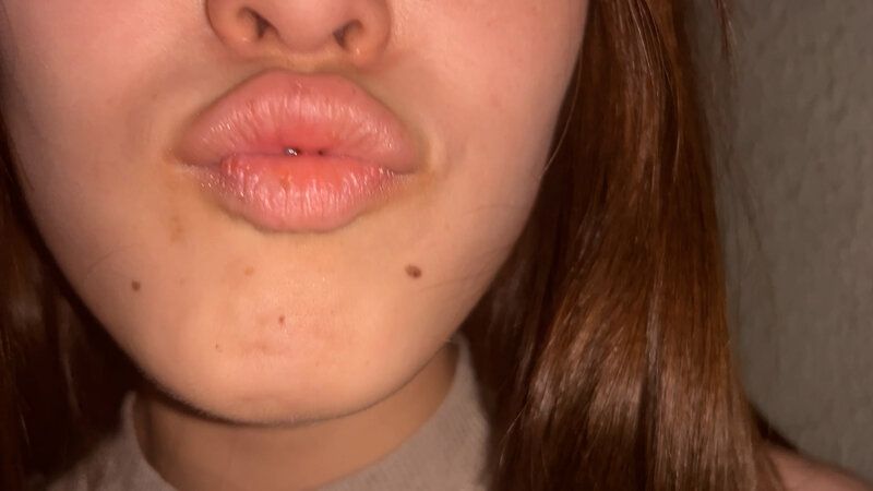 街角で声をかけて口内観察させてもらう 福祉系の専門学生 なぎさちゃん ギャラリー 5