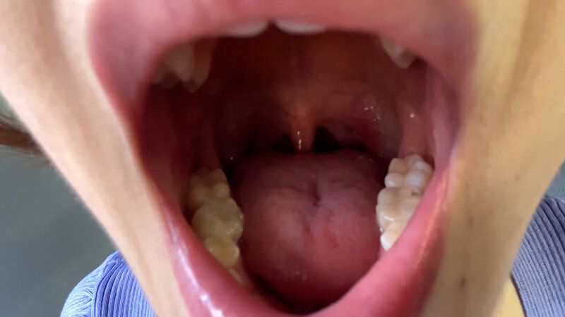 街角で声をかけて口内観察させてもらう アパレル店員 さつきちゃん ギャラリー 18