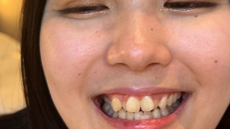 街角で声をかけて口内観察させてもらう カフェ店員 ひなちゃん ギャラリー 14