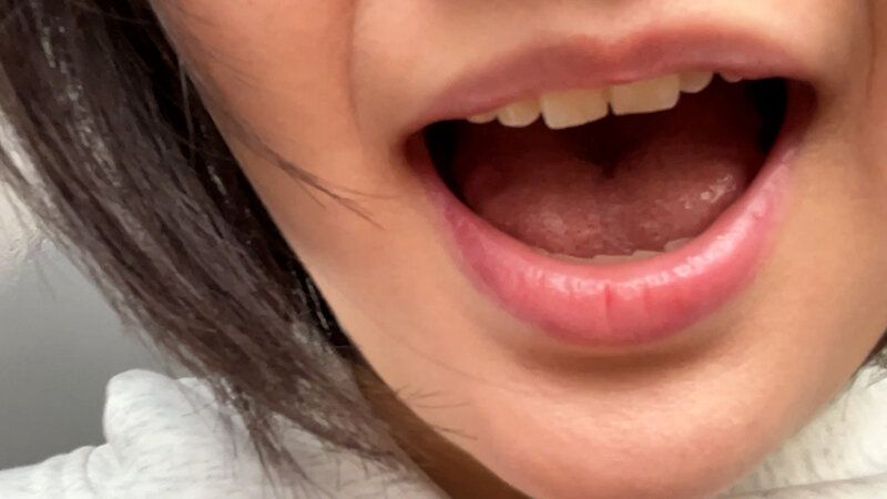 街角で声をかけて口内観察させてもらう 子供英語塾アルバイト のあちゃん ギャラリー 10