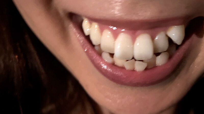 街角で声をかけて口内観察させてもらう 時計屋店員 みらいちゃん ギャラリー 9