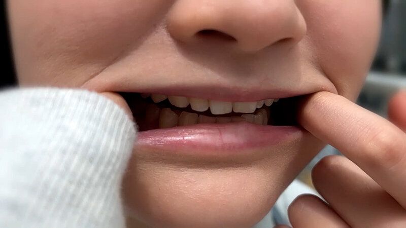 街角で声をかけて口内観察させてもらう 子供英語塾アルバイト のあちゃん ギャラリー 6