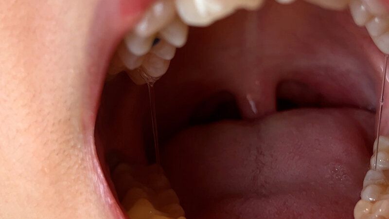 街角で声をかけて口内観察させてもらう カフェ店員 ひなちゃん ギャラリー 9