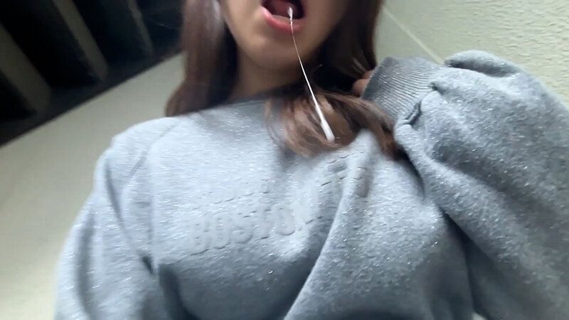 街角で声をかけて口内観察させてもらう 大学生 ゆゆちゃん ギャラリー 19