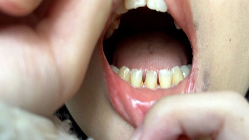 街角で声をかけて口内観察させてもらう コールセンターアルバイト あむちゃん ギャラリー 6